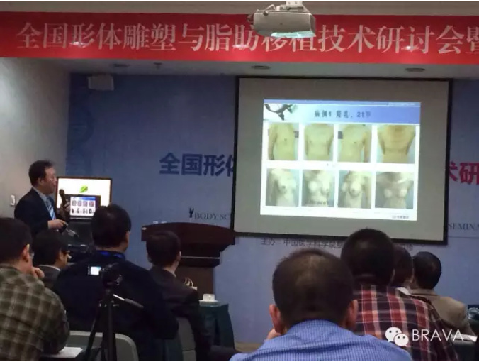 BRAVA全国形体雕塑与脂肪移植手术培训会顺利召开