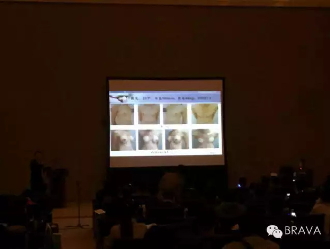 刘成胜专题讲解：山寨版效果无法与BRAVA相提并论